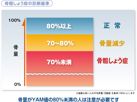 骨粗しょう症の診断基準