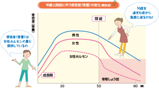 女性に多いのはなぜ？