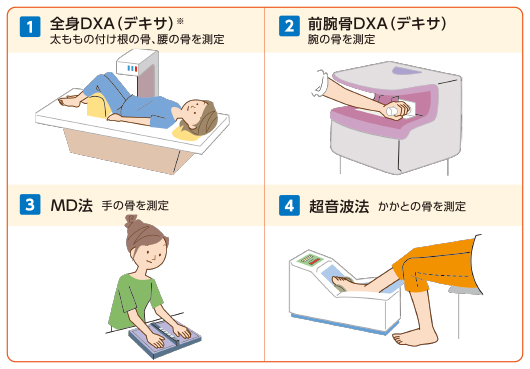 骨粗しょう症の主な検査