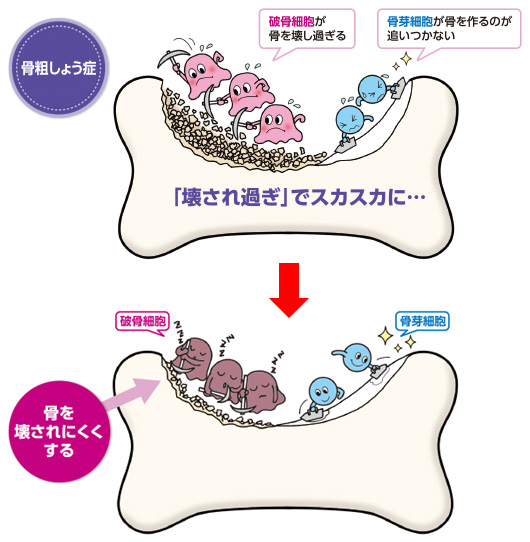 骨が壊されるのを抑える薬