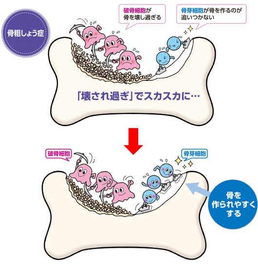 骨が作られるのを促す薬
