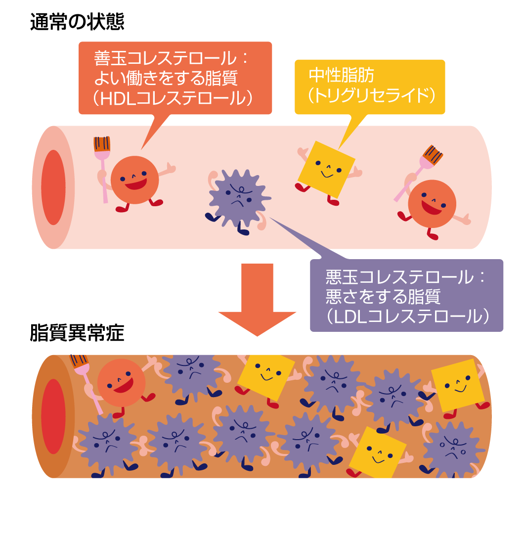 中性脂肪の数値を解説｜血圧 ・血糖値・中性脂肪｜森永乳業
